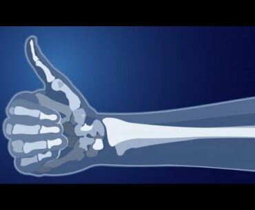 IZUMI HEALTH TALK: BONE HEALTH