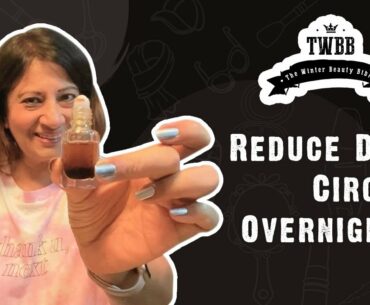 Remove Dark Circles Overnight Naturally!!! | Winter Beauty Bible | Season 1 Episode 2 | Geeta Modi