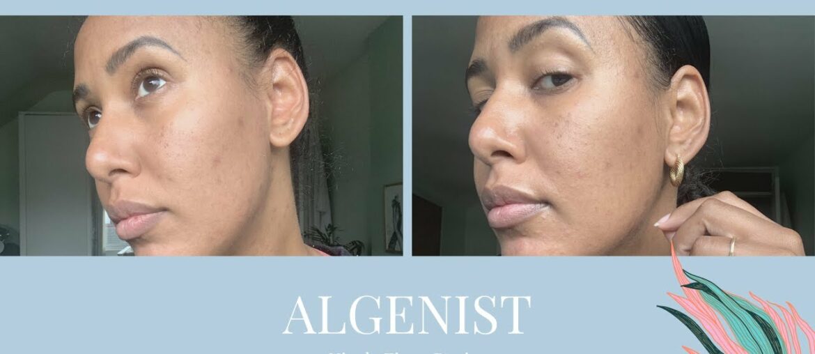 Algenist Blue Algae Vitamin C Dark Spot Correcting Peel | * REAL RESULTS * | Med - Dark Skin