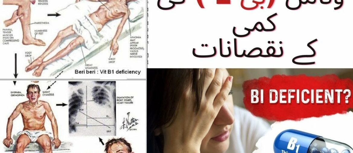 Vitamin B1 ki kami sy kya kya beemarian ho sakti hai | Lazmi daikhye