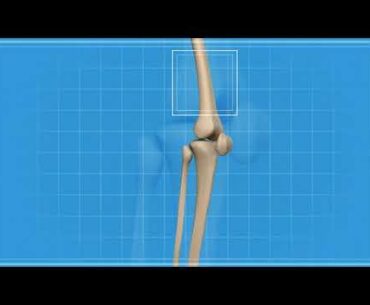 Should You Take Vitamin D and Calcium Supplements