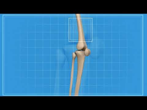 Should You Take Vitamin D and Calcium Supplements