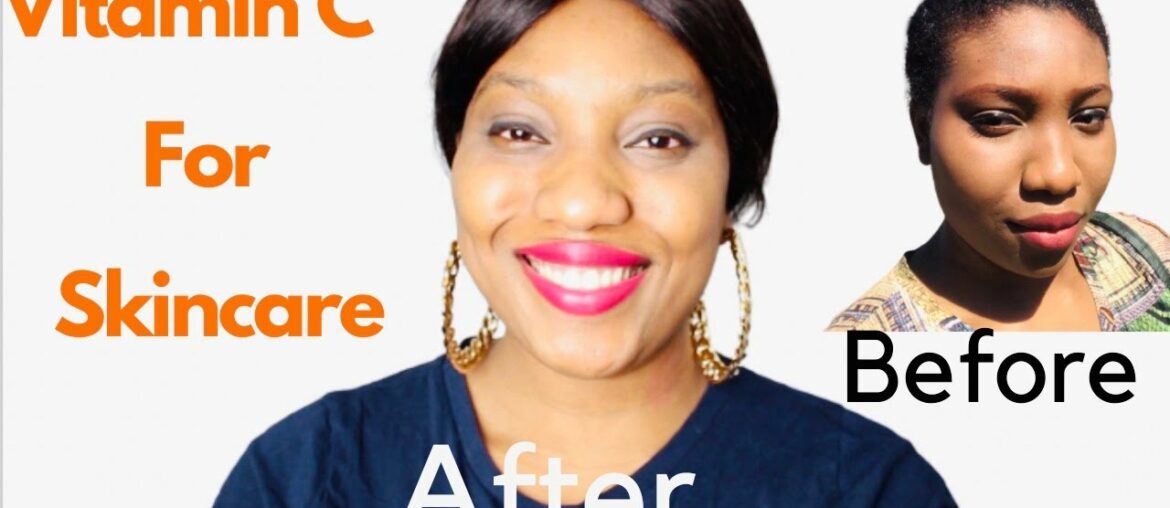 Vitamin C For Skin Brightening and Skincare - Benefits and how to use correctly