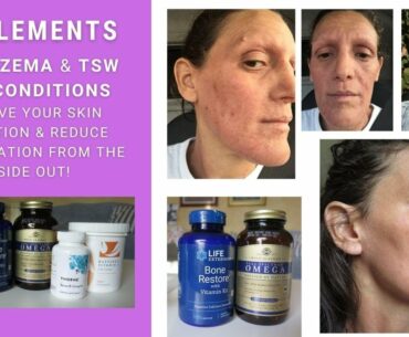 SUPPLEMENTS FOR ECZEMA & TSW SKIN CONDITIONS