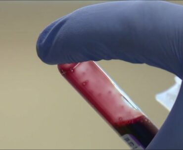 What does your blood type say about your risk of COVID-19 or cancer?