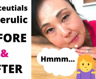 SkinceuticalsCE Ferulic Worth it?  Before and After