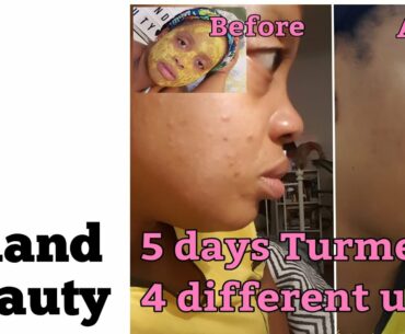 #clearskin #turmeric #beautytips  4 Overnight beauty tips- clean bright skin, smooth, soft pink lips