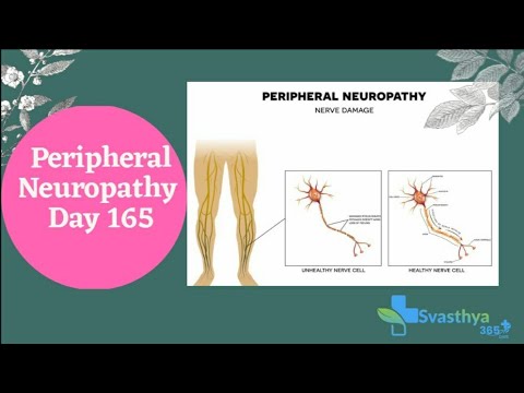 Peripheral Neuropathy  I Day 165