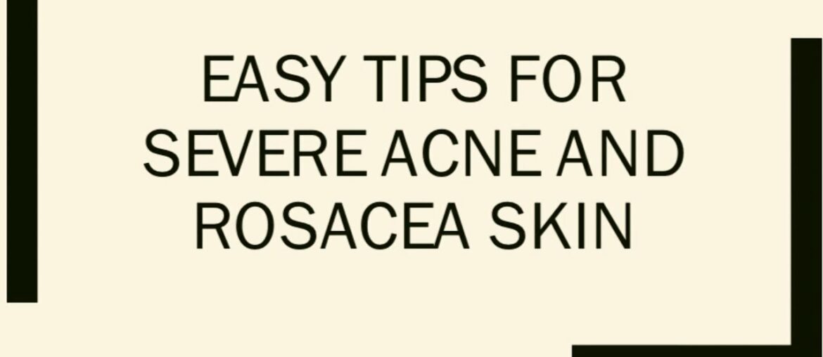 Easy tips for severe acne and rosacea skin