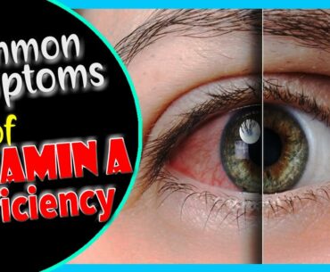 Signs of Vitamin A Deficiency