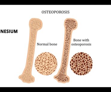 Best Calcium and Vitamin D3 Supplements for Men & Women | Calcium Foods