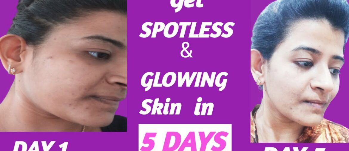 Vitamin E Oil Skin Treatment |Vitamin E oil  Benefits & Uses | DIY easy remedies for glowing skin