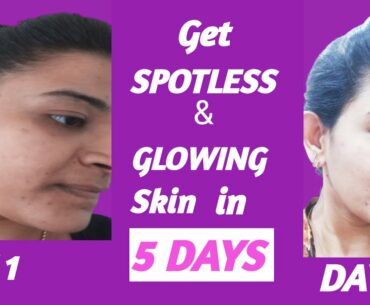 Vitamin E Oil Skin Treatment |Vitamin E oil  Benefits & Uses | DIY easy remedies for glowing skin