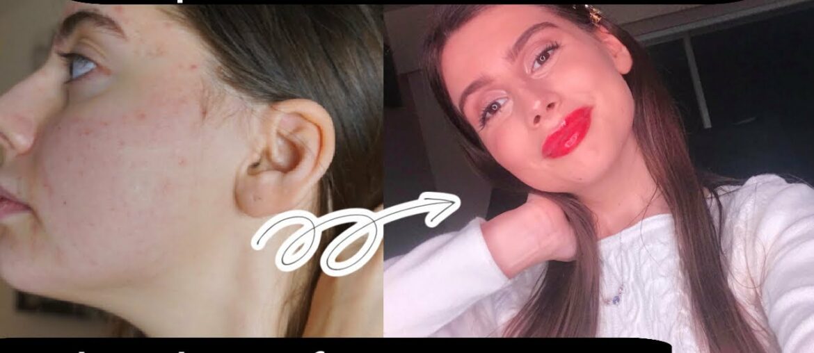 Holiday Foundation Free Acne Coverage Makeup Routine || Chit Chat: Life, Isolation, Taking it Easy