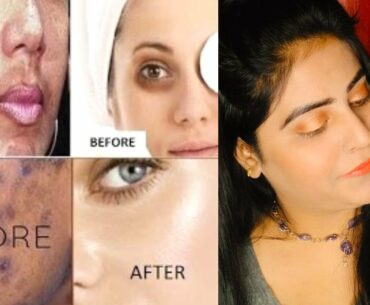 Himalyan Organics Vitamin C Night cream ,Anti pigmenration & skin glowing cream full explain