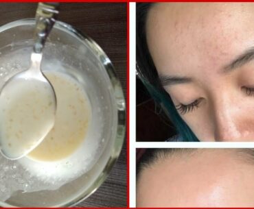 Orange(Vitamin-C) Glowing Seerum/How to use orange Juice For face Whitening/Get Milky Whitening skin