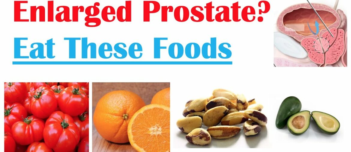 Best Foods to Eat with Enlarged Prostate | Reduce Risk of Symptoms, Enlargement & Cancer