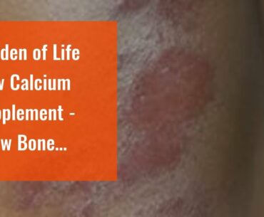 Garden of Life Raw Calcium Supplement - Grow Bone System Whole Food Vitamin with Strontium, Veg...