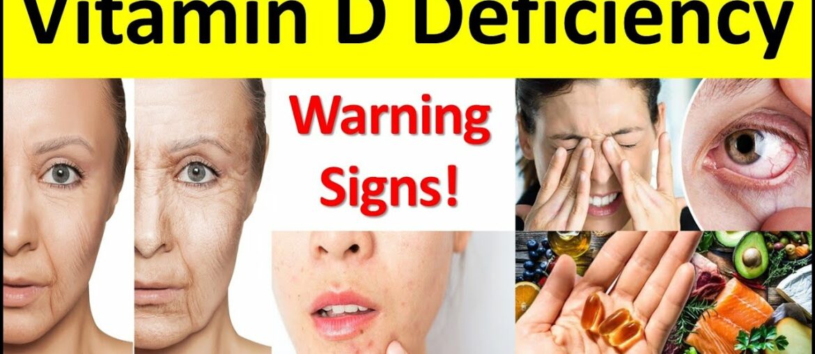 8 Signs and Symptoms of Vitamin D Deficiency | Top 6 Vitamin D Rich Food | Vitamin D Foods