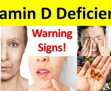 8 Signs and Symptoms of Vitamin D Deficiency | Top 6 Vitamin D Rich Food | Vitamin D Foods