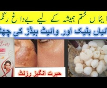 best Melasma remove  sunblock and pigmentation/Freckles remove/with natural beauty tips