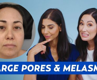 Large Pores & Melasma Skincare Routine for Monica! | DERM REACTS