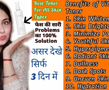 #Theoly Vitamin C Toner Mist for Face Whitening with Rosehip Oil Review- Save For Sensitive Skin