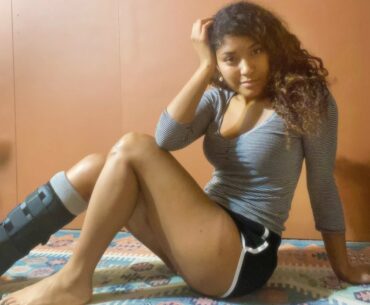 I broke my leg rollerskating | Here's a Vitamin C shot recipe