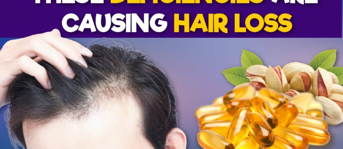 6 Nutritional Deficiencies That Cause Hair Loss