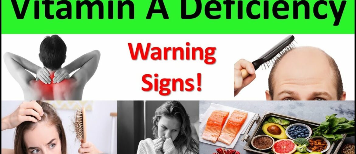 8 Signs and Symptoms of Vitamin A Deficiency | Top 10 Vitamin A Rich Food | Vitamin A Foods