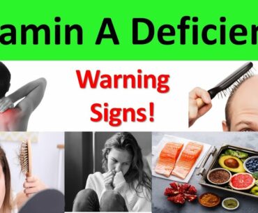 8 Signs and Symptoms of Vitamin A Deficiency | Top 10 Vitamin A Rich Food | Vitamin A Foods