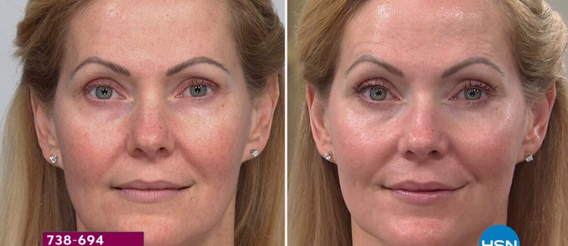 Signature Club A Vitamin C Skincare Essentials Set