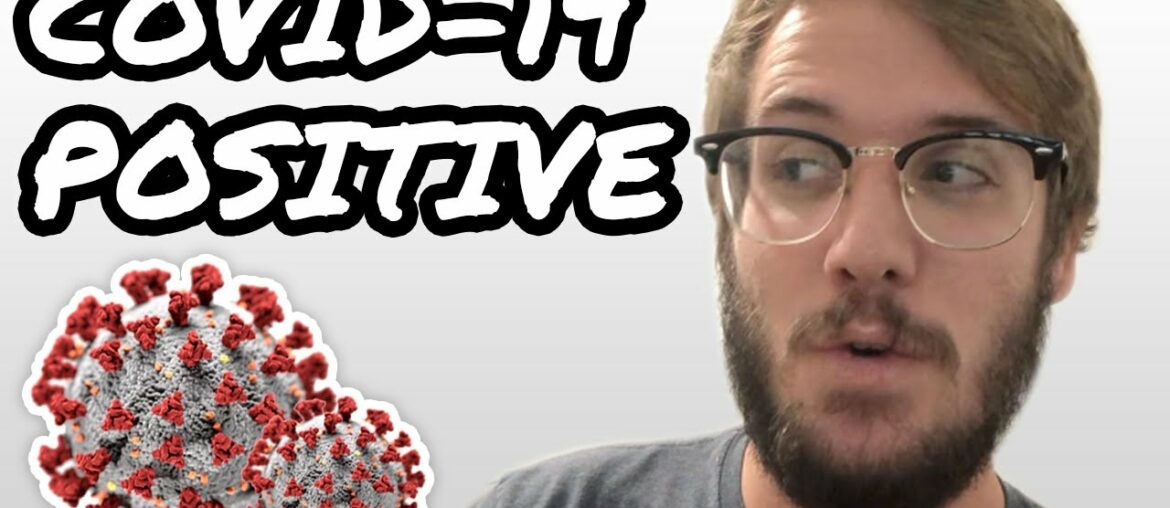 I Tested Positive For CoronaVirus | My Symptoms & Experience with COVID 19