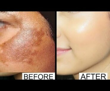 How to make Whiteing Serum at home#Vitamin C Serum get glowing & fair skin# by daily beauty's tips#