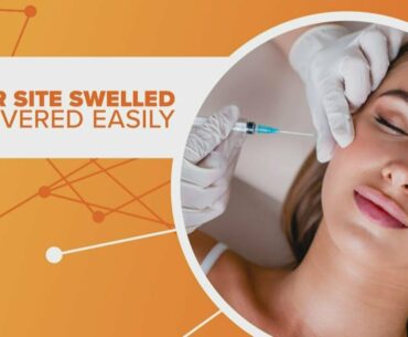 Possible adverse effects of COVID-19 vaccine on people with facial fillers