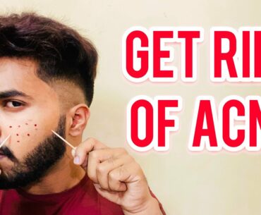 GET RID OF ACNE COMPLETELY | In Telugu | Ravinder’s Fashion
