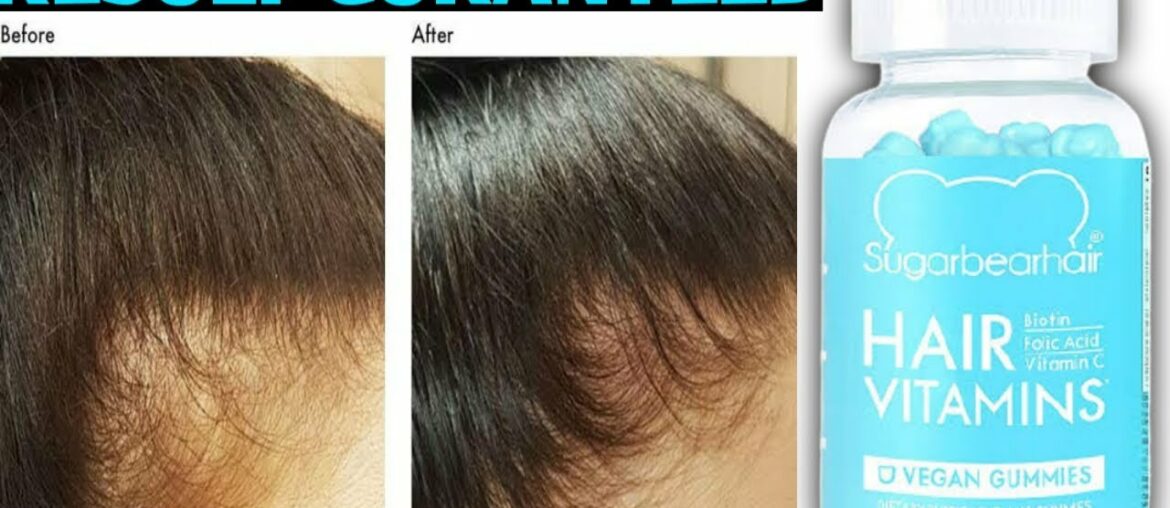 Sugarbear Hair Vitamins Review || Better Than Oziva?