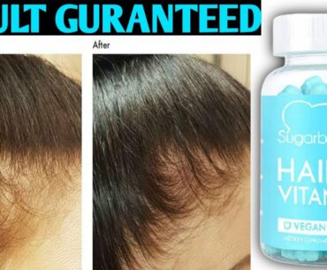 Sugarbear Hair Vitamins Review || Better Than Oziva?