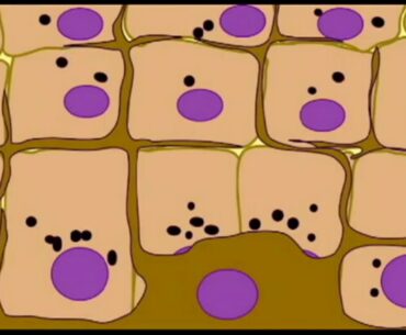 melanin in the skin, cancer risk, & vitamin D in early humans