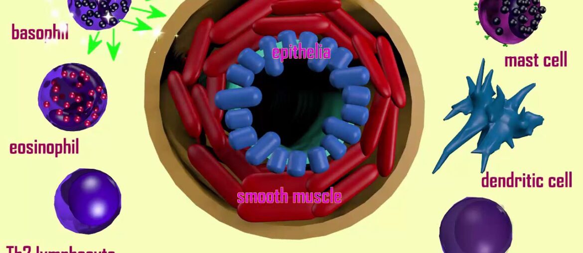 cytokine storm in coronavirus infection