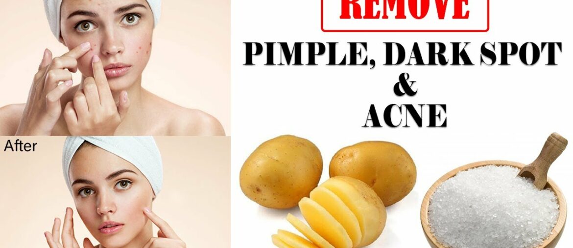 Skin Whitening serum || Potato serum ||