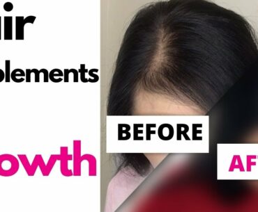 Hair Supplements for Growth - Did it work?