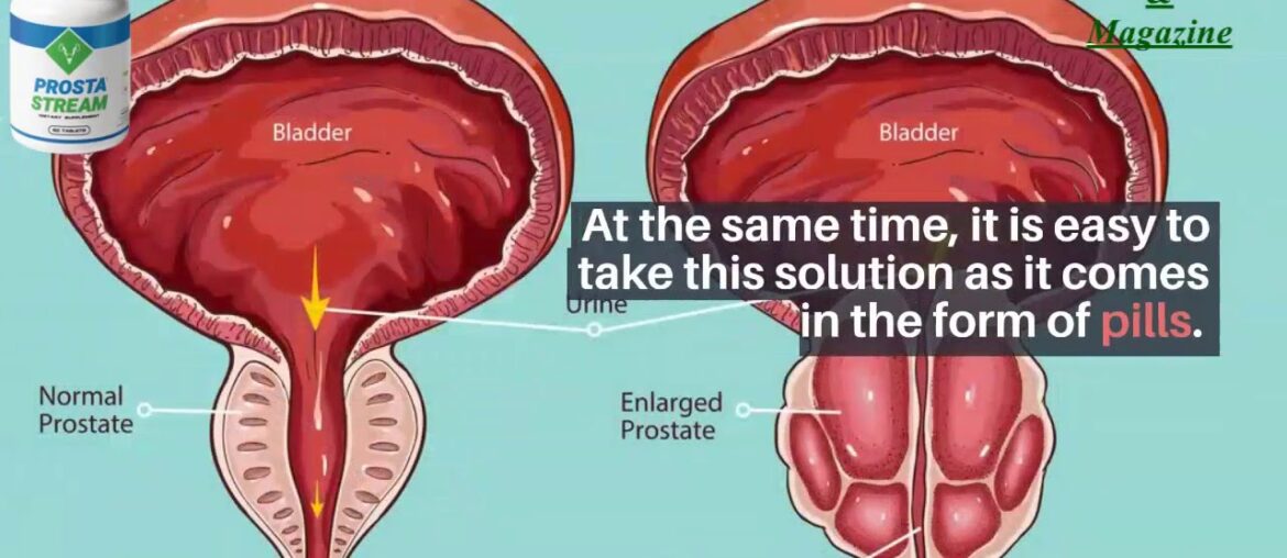 Prosta Stream UK Reviews United Kingdom Official Offer!