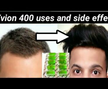 How to Use VITAMIN E capsule for HAIRGROWTH,SKIN and Health[EVION 400 uses]|EVION 400|VITAMINE E
