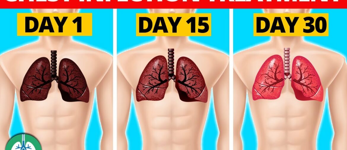 7 Natural Chest Infection Treatments (Home Remedies)