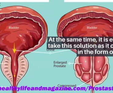 ProstaStream Pills Review 2021 Groundbreaking New Report on ProstaStream Ingredients