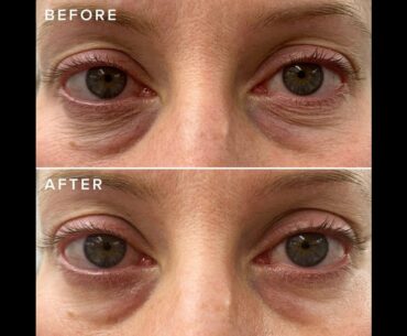 I DEW CARE Glow-Key Eye Cream with Applicator  Brightening Vitamin C Eye Serum w...