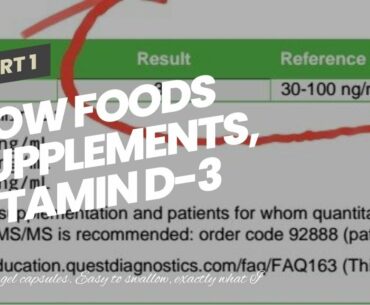 NOW Foods Supplements, Vitamin D-3 5,000 IU, High Potency, Structural Support, 240 Softgels