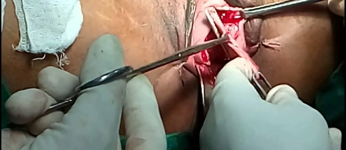 Dr Vyomesh shah NDVH