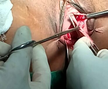 Dr Vyomesh shah NDVH